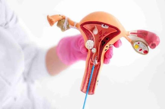 Colposcopy & Cervical Biopsy